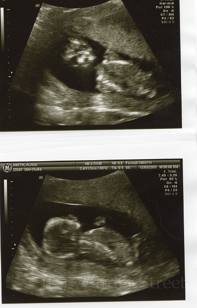 2nd Ultrasound 02.jpg